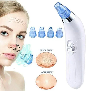 Blackhead RemoverBlackhead Remover SAND'S CART